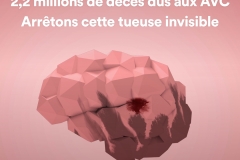 air-pollution-infographic-brain-fr air-pollution-infographic-brain-fr